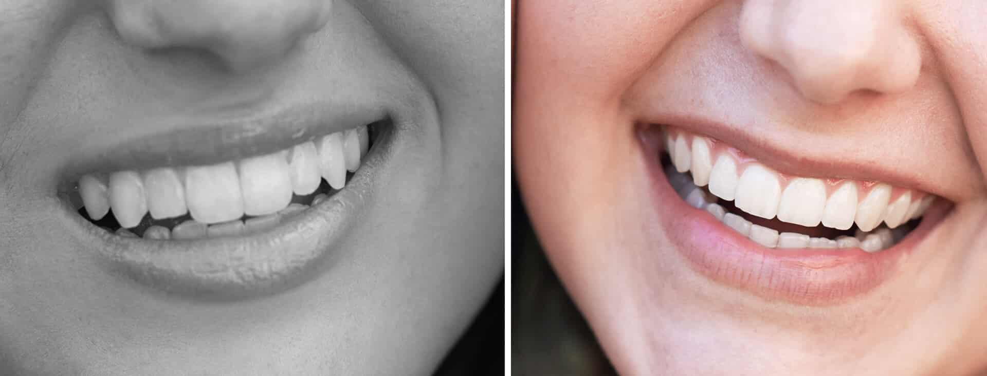 Cosmetic dentistry dental care photograph